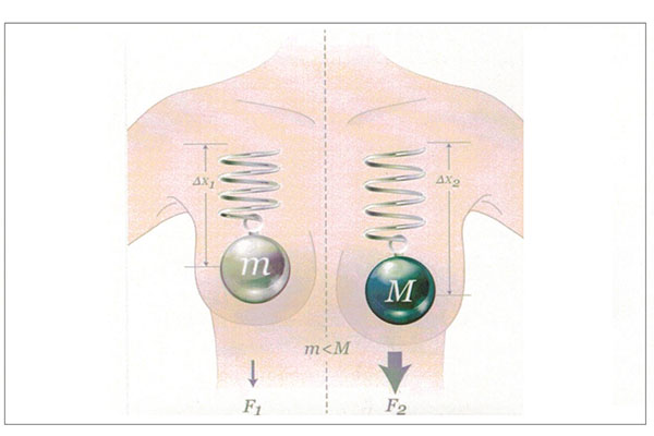 Die bis zu 30 % leichteren B-Lite-Implantate sind zur Brustvergrößerung nicht nur für Sportlerinnen sinnvoll, sondern auch für Frauen, welche ein schwaches Bindegewebe haben, oder für Frauen, die sich eine Brustvergrößerung mit Brustimplantaten wünschen,