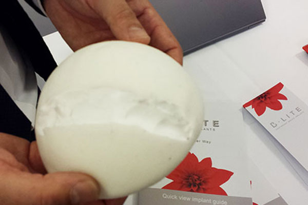 Vorstellung der B-Lite Leichtimplantate